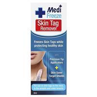 Medi Freeze Skin Tag Remover